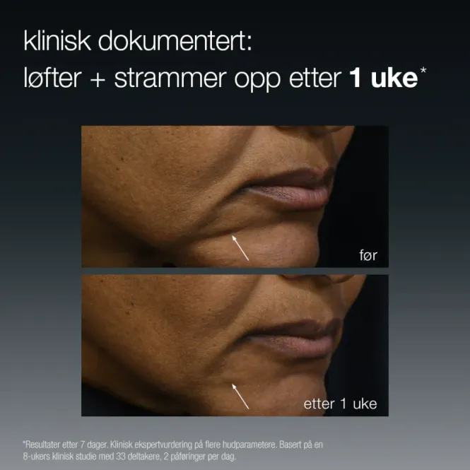 Hovedbilde Futurecode booster