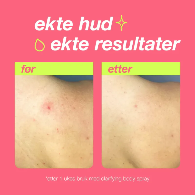 Clarifying Body Spray